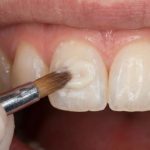 Cosmetic Dentistry