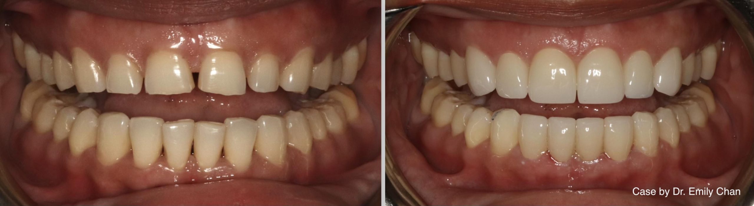 dental services