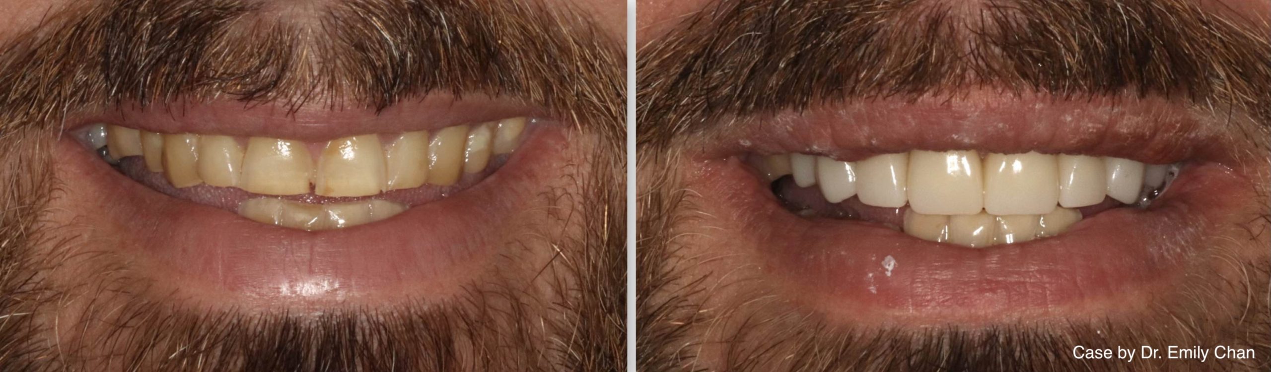 dental services