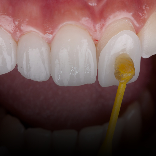 Cosmetic Dentistry