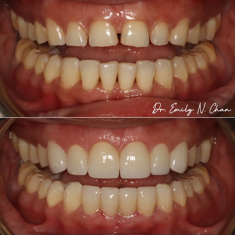 dental services