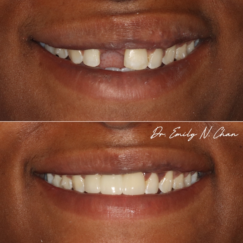 dental services